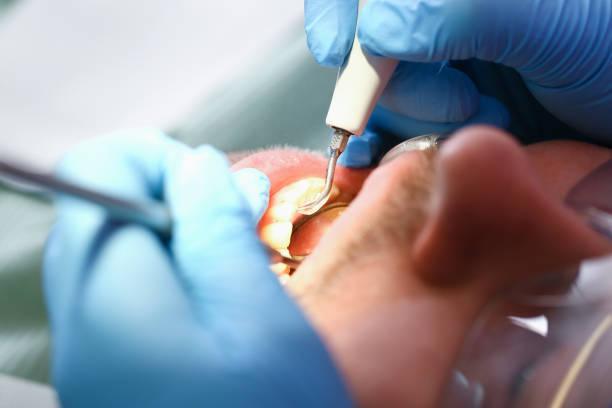 Best Emergency Treatment for Jaw Pain or Injury in Burnsville, MN