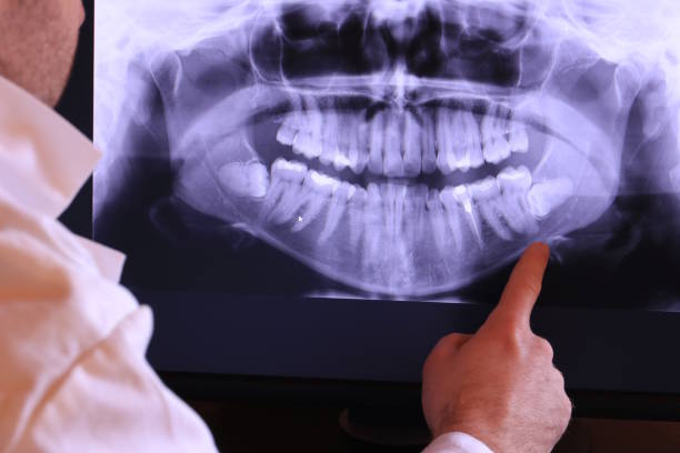 Best Emergency Treatment for Oral Infections in Burnsville, MN